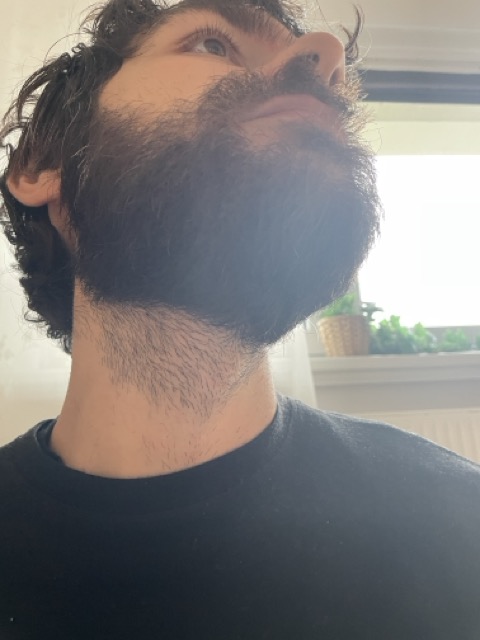 Beard / hair on the neck